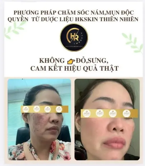 Dịch Vụ
