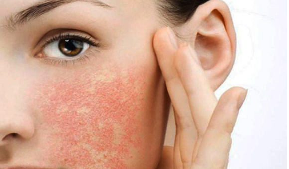 5 Dấu Hiệu Làn Da Đang “Kêu Cứu” Và Cần Điều Trị Chuyên Sâu Ngay