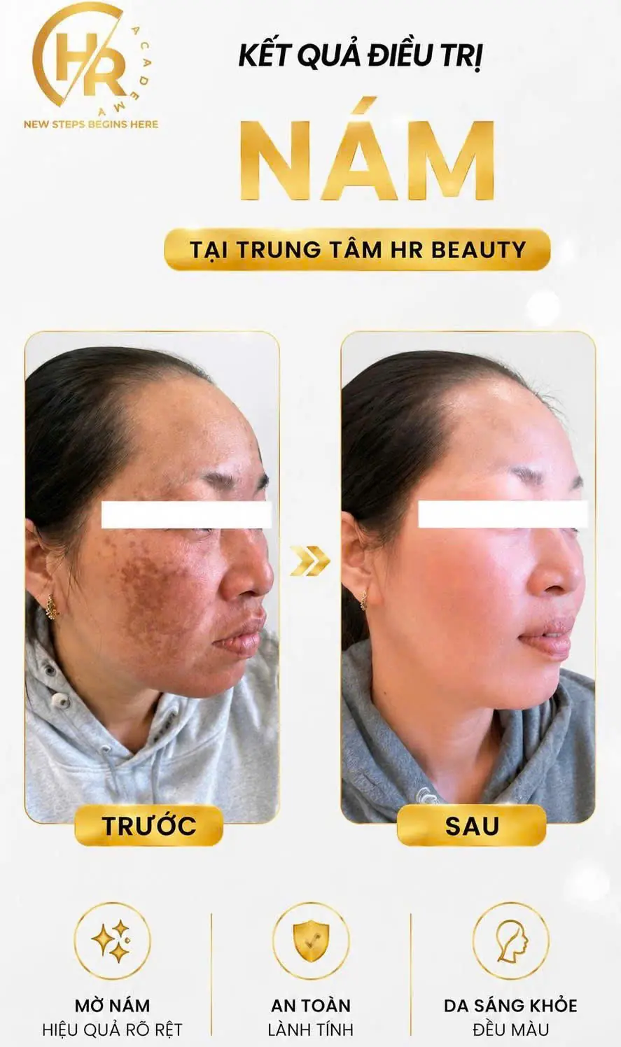 HR BEAUTY